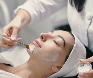 Chemical peel (Peel da)