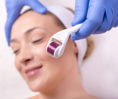 Microneedling (Lăn kim)