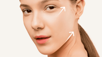 Tiêm vi điểm (Mesotherapy)